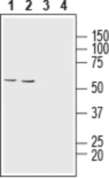 Anti-MCT1 antibody used in Western Blot (WB). GTX35258