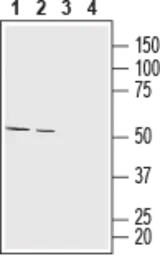 Anti-MCT1 antibody used in Western Blot (WB). GTX35258