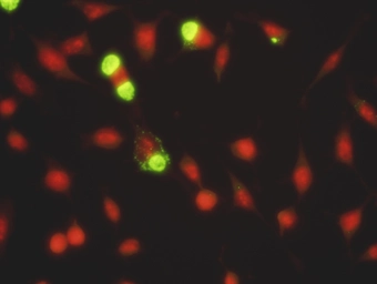 Anti-Chlamydia trachomatis LPS antibody [1681] used in Immunocytochemistry/ Immunofluorescence (ICC/IF). GTX36874