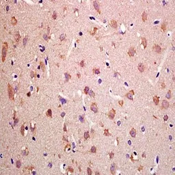 Anti-Nav1.7 antibody used in IHC (Paraffin sections) (IHC-P). GTX37345