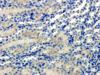 Anti-Elastin antibody used in IHC (Paraffin sections) (IHC-P). GTX37428