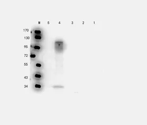 Anti-Elastin antibody used in Western Blot (WB). GTX37428