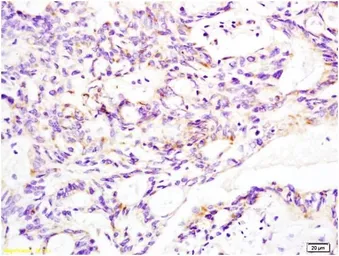 Anti-Aldolase A antibody used in IHC (Paraffin sections) (IHC-P). GTX37468