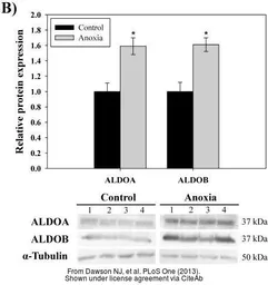 Anti-Aldolase A antibody used in Western Blot (WB). GTX37468