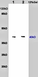 Anti-Nociceptin Receptor antibody used in Western Blot (WB). GTX37594