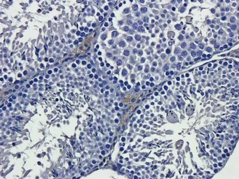 Anti-IL13 antibody used in IHC (Paraffin sections) (IHC-P). GTX37656