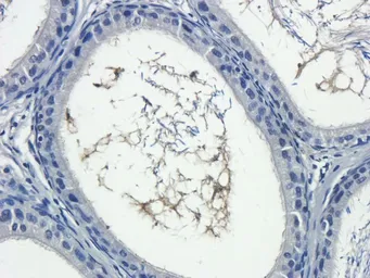 Anti-IL13 antibody used in IHC (Paraffin sections) (IHC-P). GTX37656