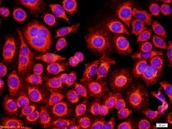 Anti-GM-CSF Receptor alpha antibody used in Immunocytochemistry/ Immunofluorescence (ICC/IF). GTX37684