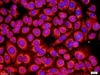 Anti-GM-CSF Receptor alpha antibody used in IHC (Frozen sections) (IHC-Fr). GTX37684