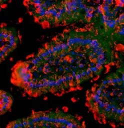 Anti-GM-CSF Receptor alpha antibody used in IHC (Paraffin sections) (IHC-P). GTX37684