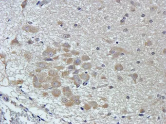 Anti-CTGF antibody used in IHC (Paraffin sections) (IHC-P). GTX37727