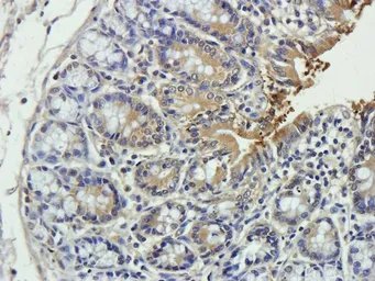 Anti-CTGF antibody used in IHC (Paraffin sections) (IHC-P). GTX37727