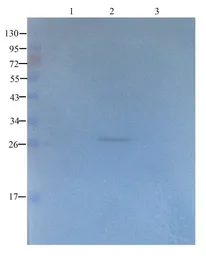 Anti-CTGF antibody used in Western Blot (WB). GTX37727