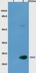 Anti-Casein antibody used in Western Blot (WB). GTX37769