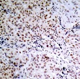 Anti-Rb (phospho Ser795) antibody used in IHC (Paraffin sections) (IHC-P). GTX38604