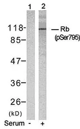 Anti-Rb (phospho Ser795) antibody used in Western Blot (WB). GTX38604