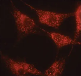 Anti-alpha 1,2 Mannosidase IA antibody used in Immunocytochemistry/ Immunofluorescence (ICC/IF). GTX40044