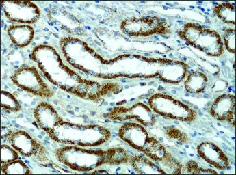 Anti-alpha 1,2 Mannosidase IA antibody used in IHC (Paraffin sections) (IHC-P). GTX40044