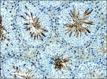 Anti-alpha 1,2 Mannosidase IA antibody used in IHC (Paraffin sections) (IHC-P). GTX40044