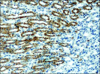 Anti-alpha 1,2 Mannosidase IA antibody used in IHC (Paraffin sections) (IHC-P). GTX40044