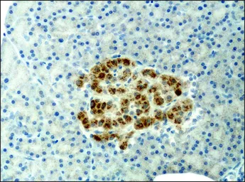 Anti-alpha 1,2 Mannosidase IA antibody used in IHC (Paraffin sections) (IHC-P). GTX40044