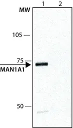 Anti-alpha 1,2 Mannosidase IA antibody used in Western Blot (WB). GTX40044