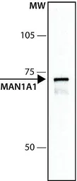 Anti-alpha 1,2 Mannosidase IA antibody used in Western Blot (WB). GTX40044