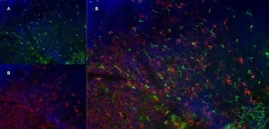 Anti-CD68 antibody [FA-11] used in IHC (Frozen sections) (IHC-Fr). GTX41866