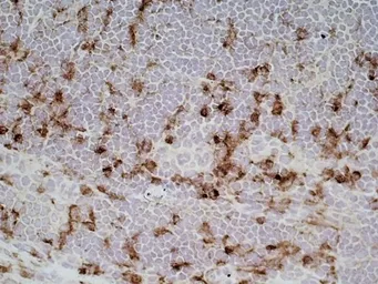 Anti-CD68 antibody [ED1] used in IHC (Frozen sections) (IHC-Fr). GTX41868