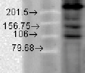 Anti-Cav1.2 antibody [S57-46] used in Western Blot (WB). GTX41981