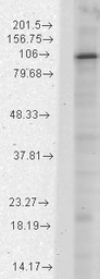 Anti-HCN1 antibody [S70-28] used in Western Blot (WB). GTX41985