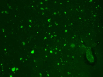 Anti-HCN2 antibody [S71-37] used in Immunocytochemistry/ Immunofluorescence (ICC/IF). GTX41986