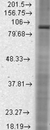 Anti-HCN2 antibody [S71-37] used in Western Blot (WB). GTX41986