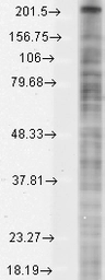 Anti-Nav1.8 antibody [S134-12] used in Western Blot (WB). GTX42021