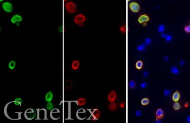 SARS-CoV-2 (COVID-19) Spike FFPE 293T cell pellet block. GTX435640