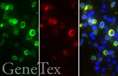 SARS-CoV-2 (COVID-19) Nucleocapsid FFPE 293T cell pellet Block. GTX435641