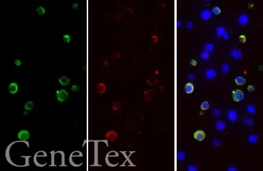 SARS-CoV-2 (COVID-19) Spike S1 FFPE 293T cell pellet block. GTX435643