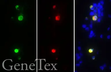 SARS-CoV-2 (COVID-19) Spike S2 FFPE 293T cell pellet block. GTX435644