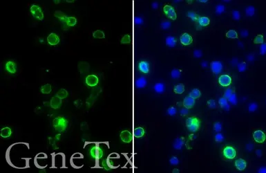 SARS-CoV-2 (COVID-19) Membrane FFPE 293T cell pellet Block. GTX435645