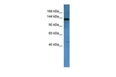 Anti-AF4 antibody, N-term used in Western Blot (WB). GTX44608