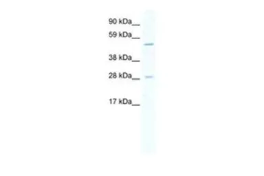 Anti-ASCL2 antibody, Internal used in Western Blot (WB). GTX44648