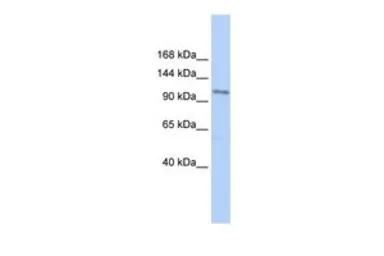 Anti-TRPC3 antibody, N-term used in Western Blot (WB). GTX44826