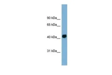 Anti-KIAA1704 antibody, Internal used in Western Blot (WB). GTX44935