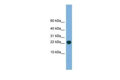 Anti-POP5 antibody, Internal used in Western Blot (WB). GTX45027