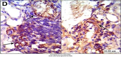 Anti-TGF beta 1 antibody used in IHC (Paraffin sections) (IHC-P). GTX45121