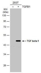 Anti-TGF beta 1 antibody used in Western Blot (WB). GTX45121