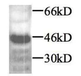 Anti-TGF beta 1 antibody used in Western Blot (WB). GTX45121