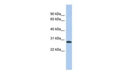 Anti-LYSMD1 antibody, N-term used in Western Blot (WB). GTX45131