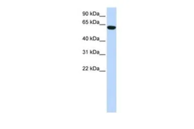 Anti-CCDC11 antibody, N-term used in Western Blot (WB). GTX45274