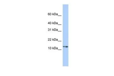 Anti-GNGT2 antibody, Internal used in Western Blot (WB). GTX45286